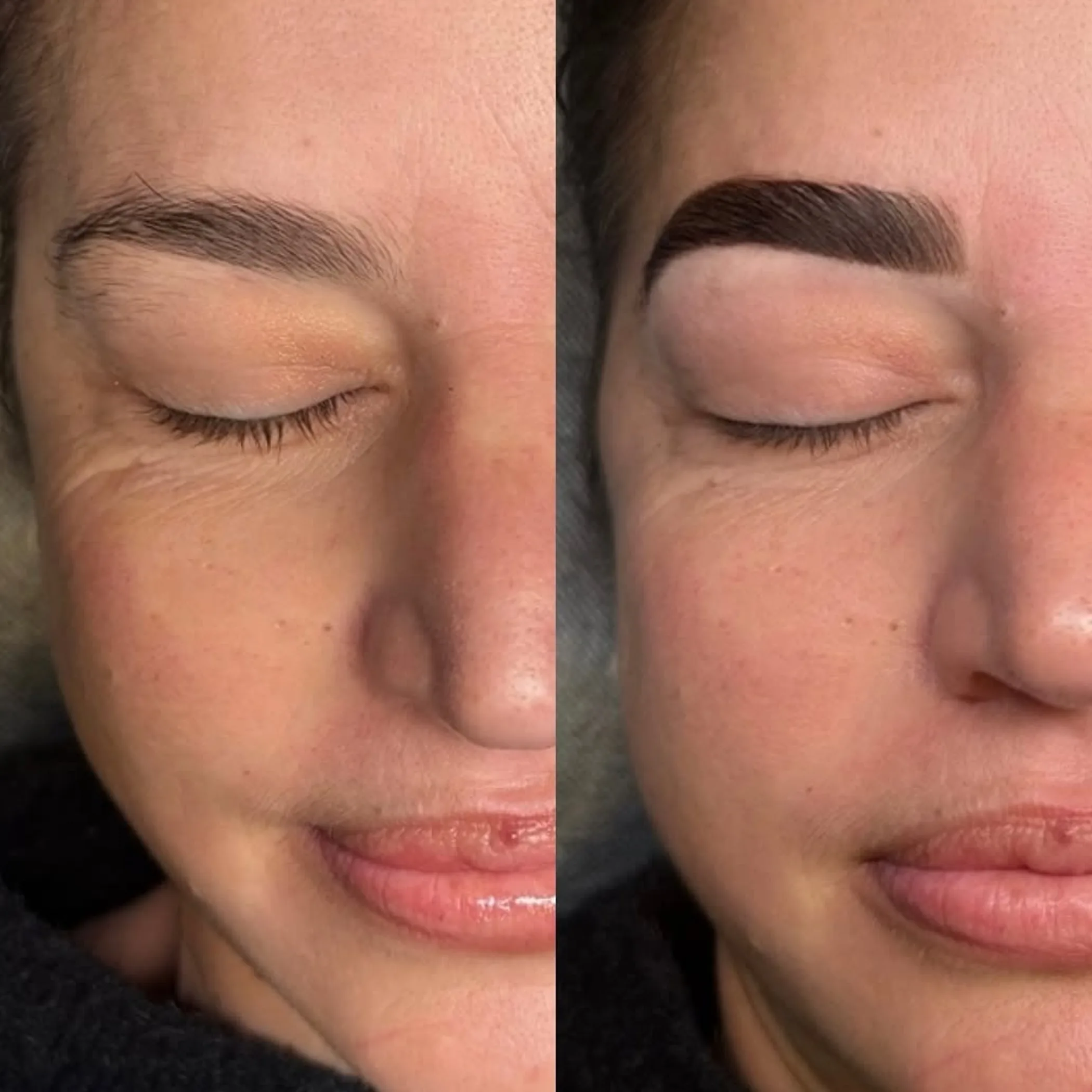 beauty treatment comparison photo